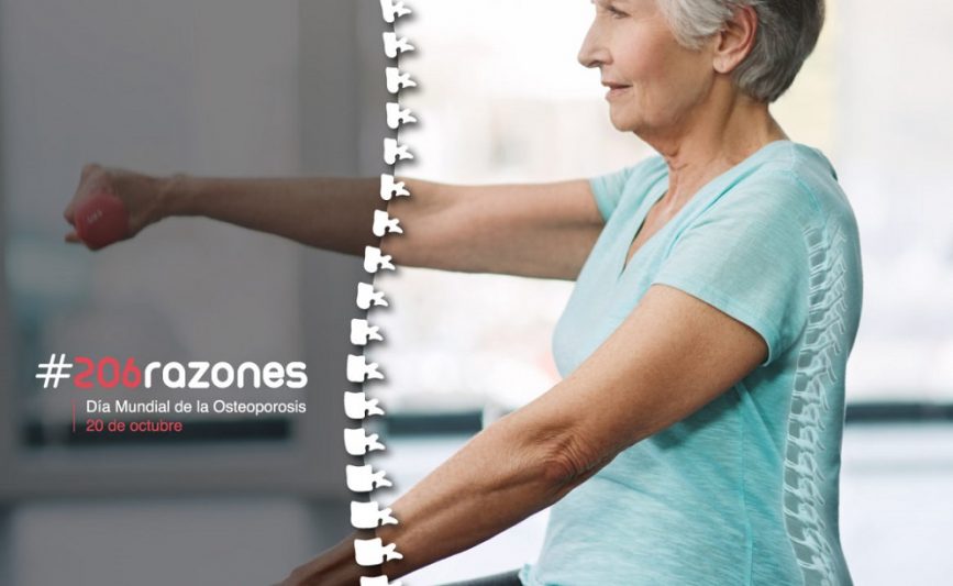 Prevenir Cada Año 1200 Fracturas óseas Por La Osteoporosis Somos Pacientes 7149