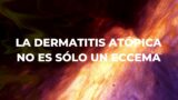 Paciente de dermatitis atópica por un día (II): el impacto en el entorno social y laboral